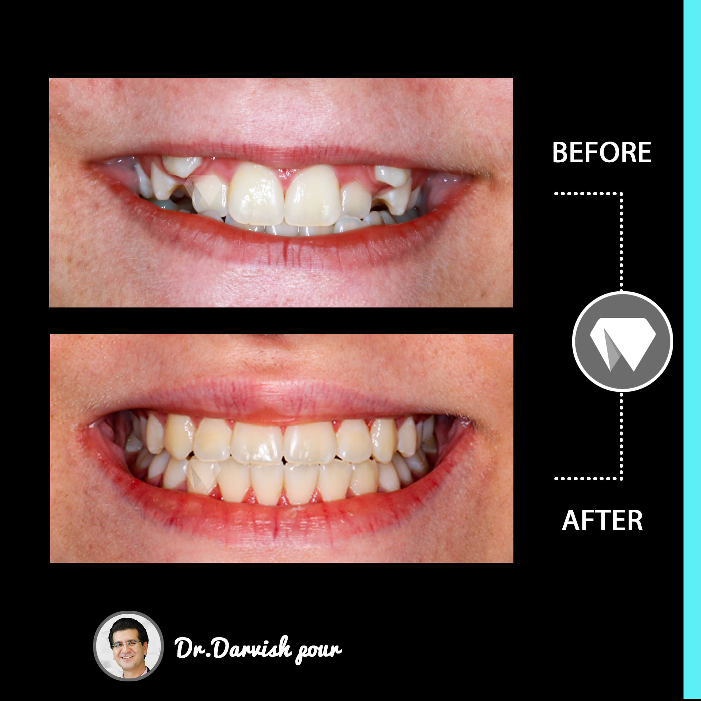 1783orthodontics-before-after-photo
