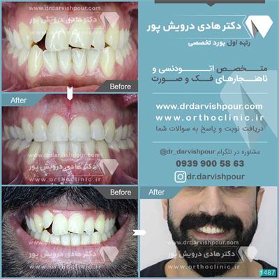 محنحنمن